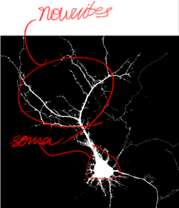 Neurites and Somata